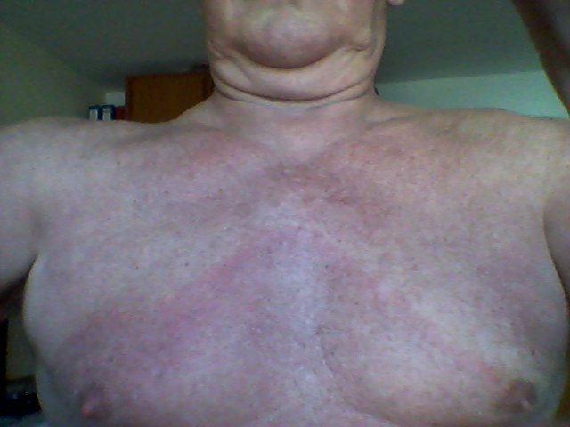 Sticht