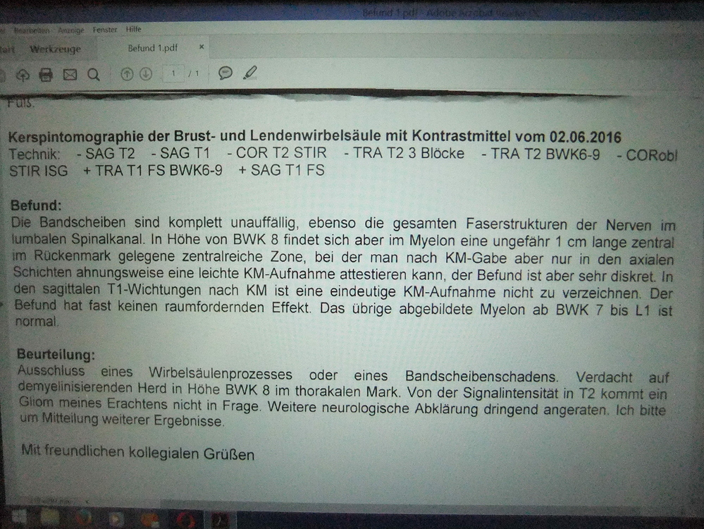 MRT Befund, MS, Multiple Sklerose werweisswas.de