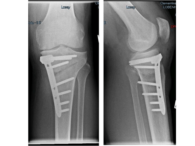 Knie_Bilder_Ausschnitt